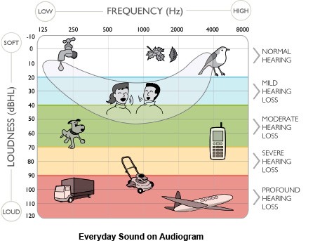 audiogram